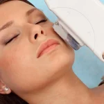 عوارض لیزر موهای زائد؛ بررسی خطرات، راهکارهای پیشگیری و درمان